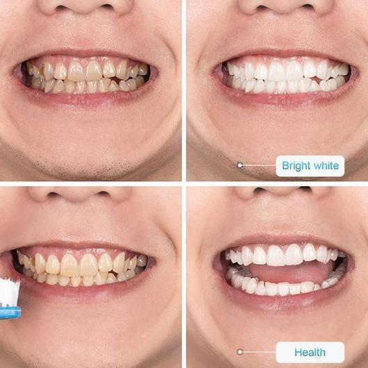 toothpaste 4 530x c51ab4cf 2b34 40b5 83c2 9c3461a494f3 540x 750x 1024x1024 2x 1024x1024 2x 25e6e8eb df6a 491d bc69 360f3b220ef8